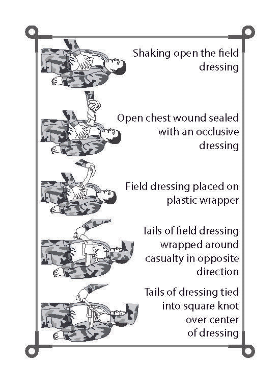 Medical Series: Army First-Aid | TC 4-02.1 and FM 4-25.11 | Army Flashcards